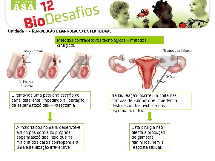 Unidade 1 - REPRODUÇÃO E MANIPULAÇÃO DA FERTILIDADE Métodos contraceptivos tecnológicos – métodos cirúrgicos