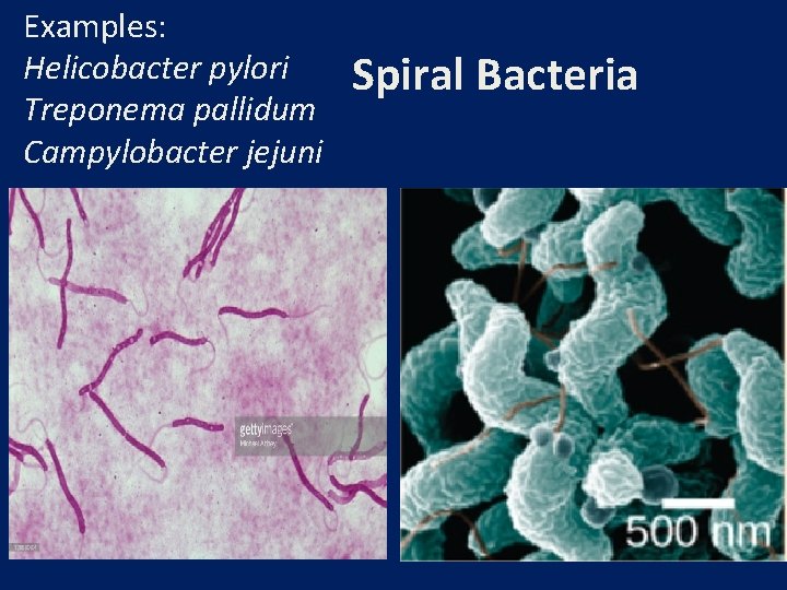 Examples: Helicobacter pylori Treponema pallidum Campylobacter jejuni Spiral Bacteria 