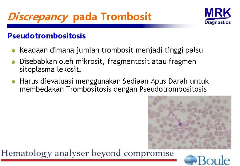 Discrepancy pada Trombosit Pseudotrombositosis Keadaan dimana jumlah trombosit menjadi tinggi palsu Disebabkan oleh mikrosit,