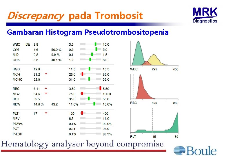 Discrepancy pada Trombosit Gambaran Histogram Pseudotrombositopenia 