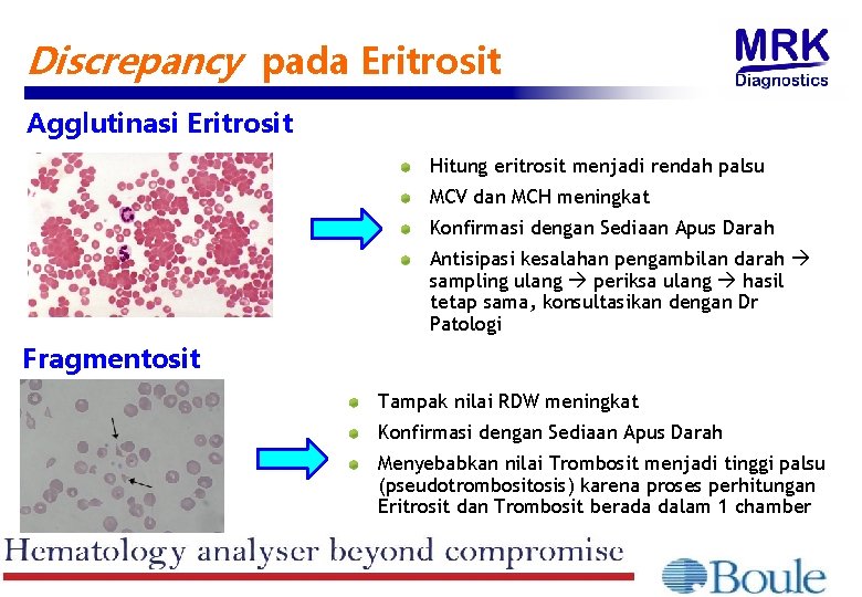 Discrepancy pada Eritrosit Agglutinasi Eritrosit Hitung eritrosit menjadi rendah palsu MCV dan MCH meningkat