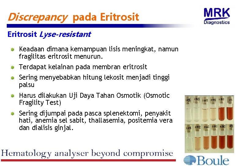 Discrepancy pada Eritrosit Lyse-resistant Keadaan dimana kemampuan lisis meningkat, namun fragilitas eritrosit menurun. Terdapat