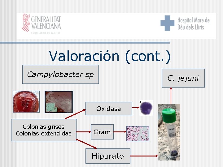 Valoración (cont. ) Campylobacter sp C. jejuni Oxidasa Colonias grises Colonias extendidas Gram Hipurato