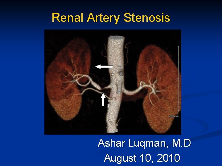 Renal Artery Stenosis Ashar Luqman, M. D August 10, 2010 