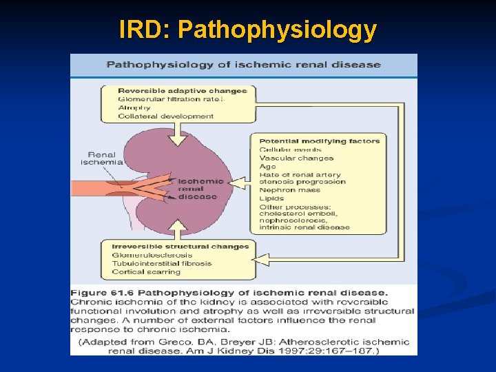 IRD: Pathophysiology 