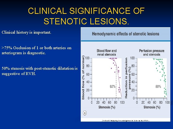 CLINICAL SIGNIFICANCE OF STENOTIC LESIONS. Clinical history is important. >75% Occlusion of 1 or