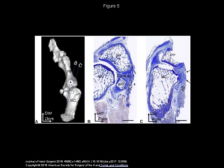 Figure 5 Journal of Hand Surgery 2018 43682. e 1 -682. e 8 DOI: