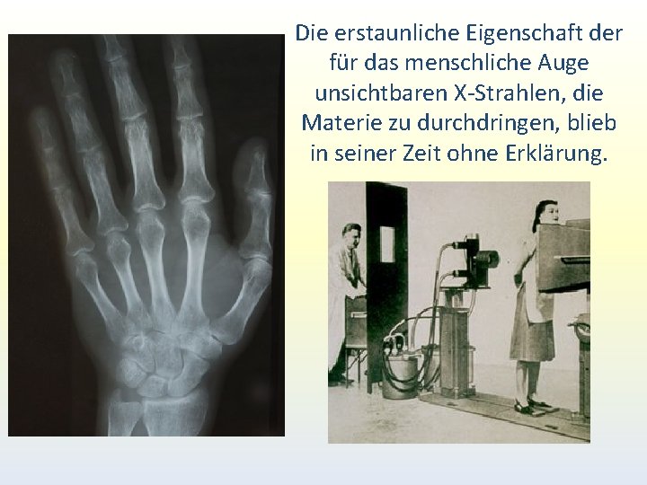 Die erstaunliche Eigenschaft der für das menschliche Auge unsichtbaren X-Strahlen, die Materie zu durchdringen, Die erstaunliche Eigenschaft der für das menschliche Auge unsichtbaren X-Strahlen, die Materie zu durchdringen,