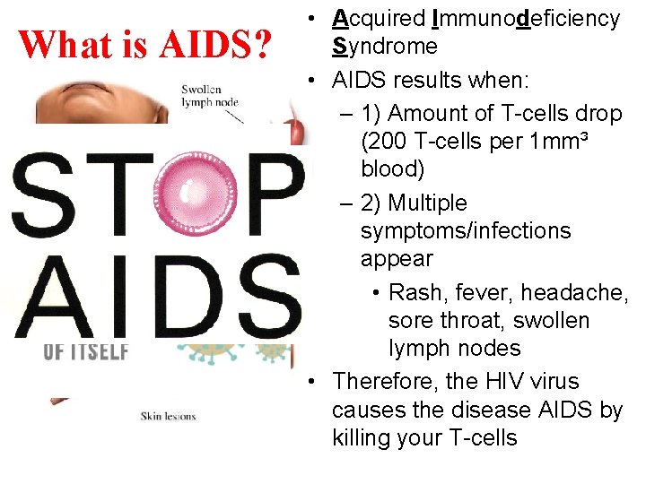 What is AIDS? • Acquired Immunodeficiency Syndrome • AIDS results when: – 1) Amount
