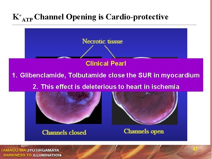 K+ATP Channel Opening is Cardio-protective Clinical Pearl 1. Glibenclamide, Tolbutamide close the SUR in