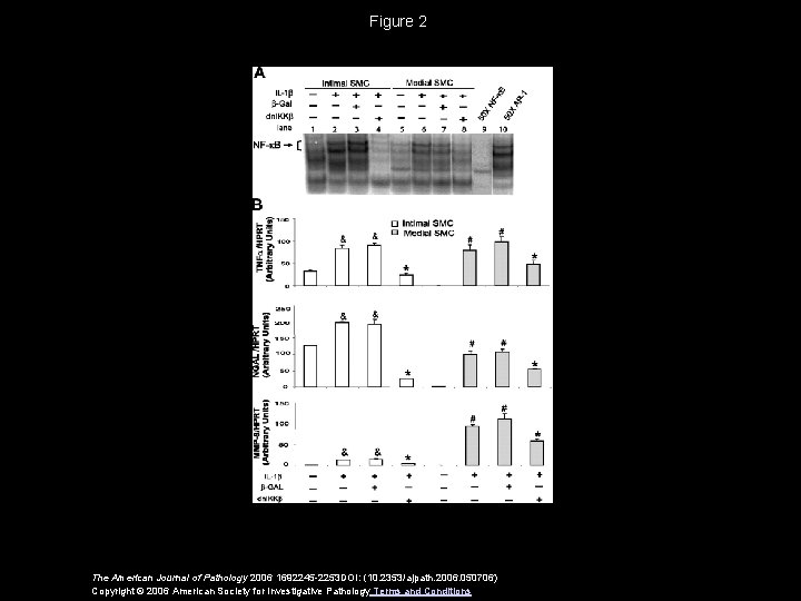 Figure 2 The American Journal of Pathology 2006 1692245 -2253 DOI: (10. 2353/ajpath. 2006.