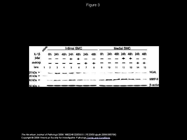 Figure 3 The American Journal of Pathology 2006 1692245 -2253 DOI: (10. 2353/ajpath. 2006.