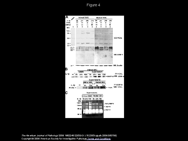 Figure 4 The American Journal of Pathology 2006 1692245 -2253 DOI: (10. 2353/ajpath. 2006.