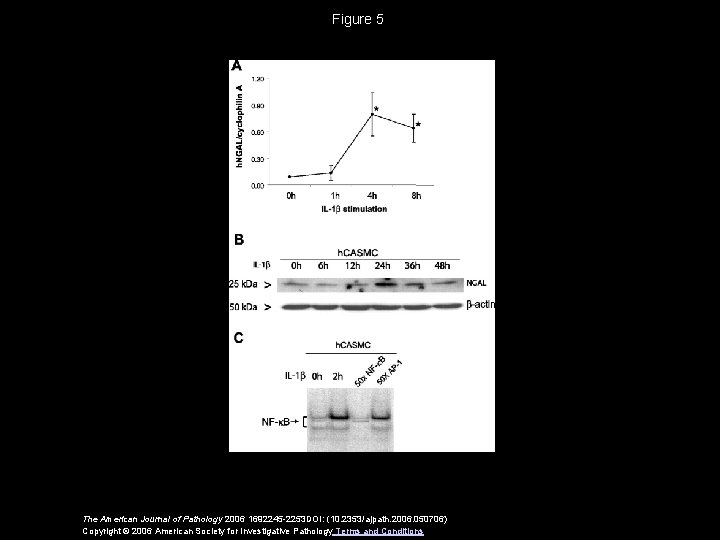 Figure 5 The American Journal of Pathology 2006 1692245 -2253 DOI: (10. 2353/ajpath. 2006.