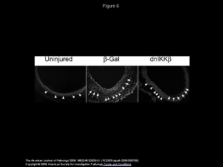 Figure 6 The American Journal of Pathology 2006 1692245 -2253 DOI: (10. 2353/ajpath. 2006.