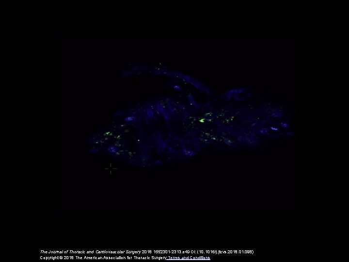 The Journal of Thoracic and Cardiovascular Surgery 2018 1552301 -2313. e 4 DOI: (10.