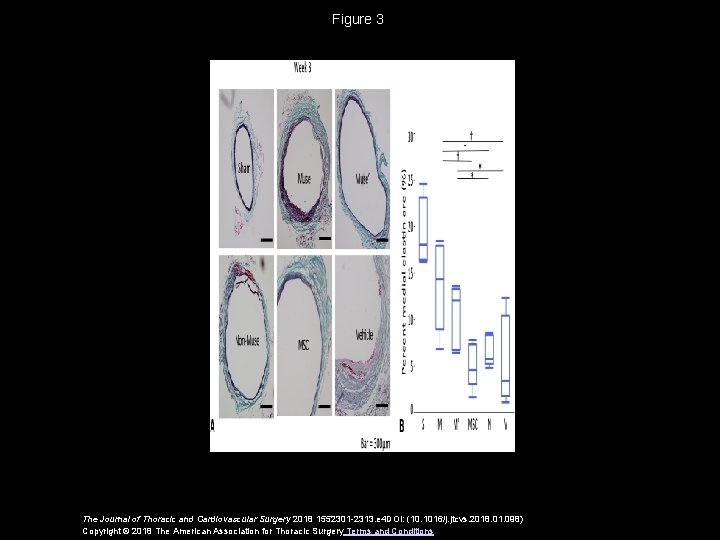 Figure 3 The Journal of Thoracic and Cardiovascular Surgery 2018 1552301 -2313. e 4