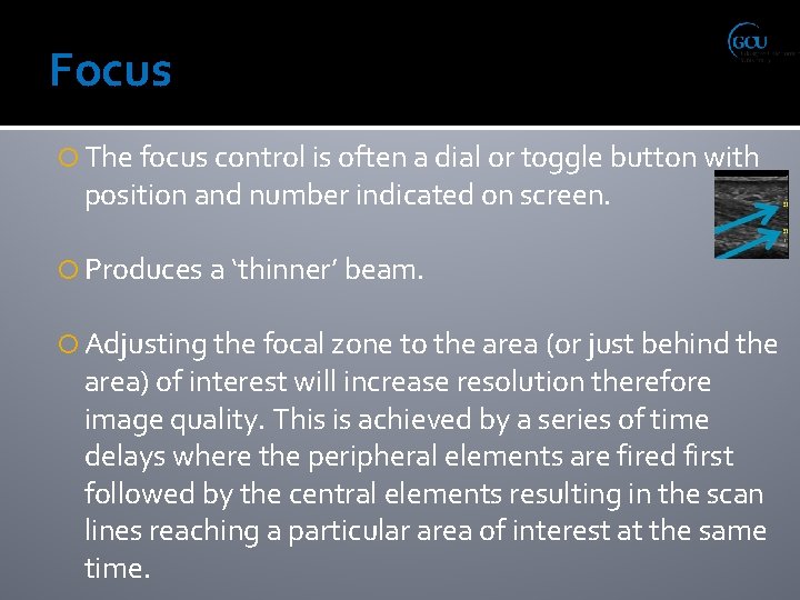 Focus The focus control is often a dial or toggle button with position and