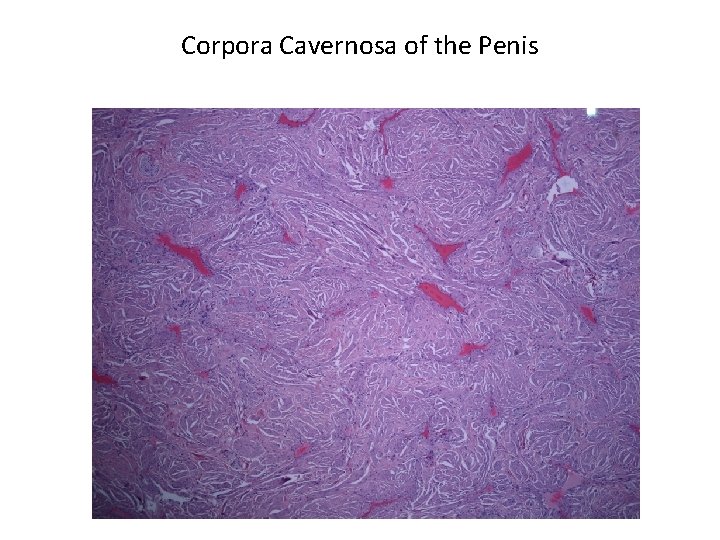 Corpora Cavernosa of the Penis 