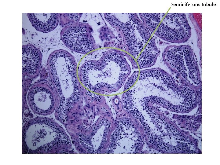 Seminiferous tubule 