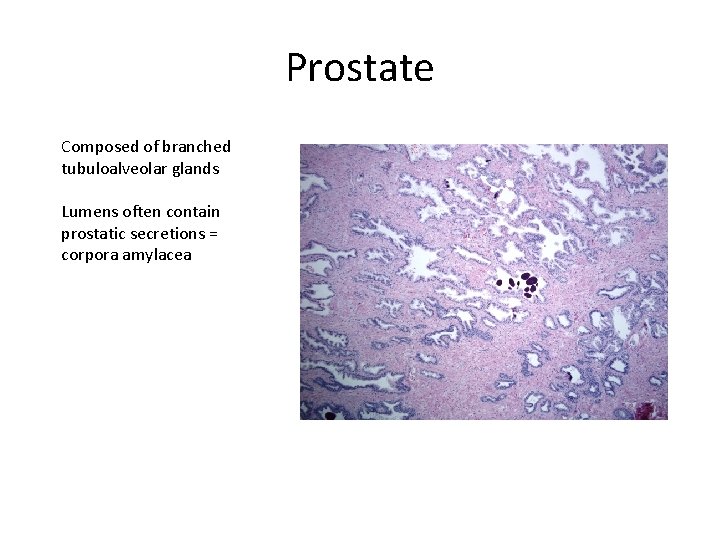 Prostate Composed of branched tubuloalveolar glands Lumens often contain prostatic secretions = corpora amylacea