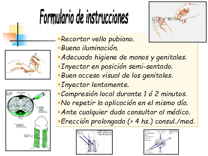 §Recortar vello pubiano. §Buena iluminación. §Adecuada higiene de manos y genitales. §Inyectar en posición