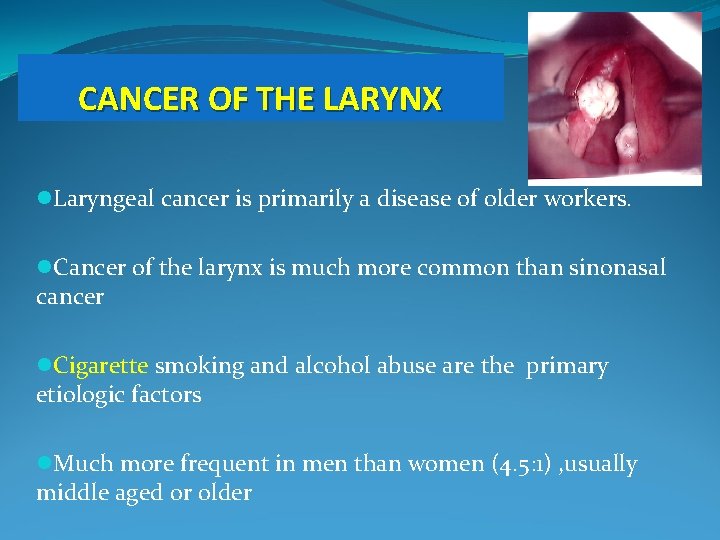 CANCER OF THE LARYNX l. Laryngeal cancer is primarily a disease of older workers.
