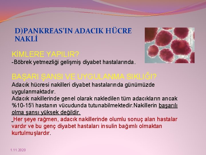 D)PANKREAS’IN ADACIK HÜCRE NAKLİ KİMLERE YAPILIR? -Böbrek yetmezliği gelişmiş diyabet hastalarında. BAŞARI ŞANSI VE