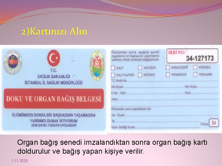 2)Kartınızı Alın Organ bağış senedi imzalandıktan sonra organ bağış kartı doldurulur ve bağış yapan