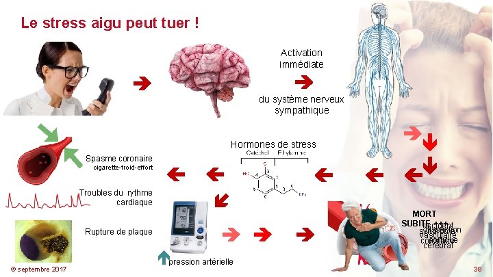 Le stress aigu peut tuer ! Activation immédiate du système nerveux sympathique Troubles du