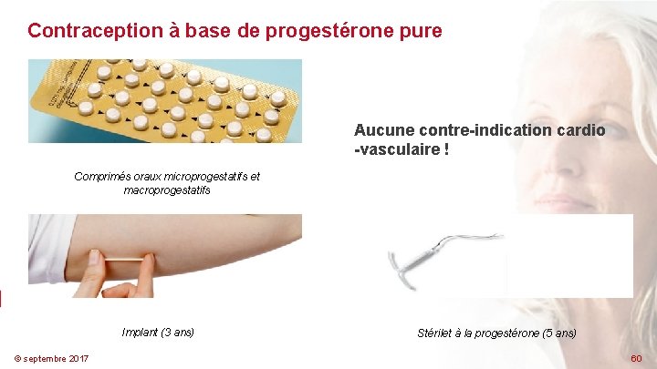 Contraception à base de progestérone pure Aucune contre-indication cardio -vasculaire ! Comprimés oraux microprogestatifs