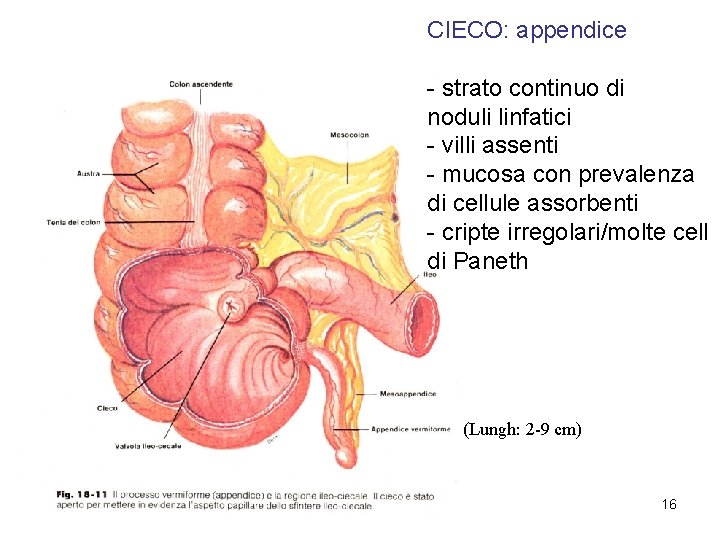 CIECO: appendice - strato continuo di noduli linfatici - villi assenti - mucosa con