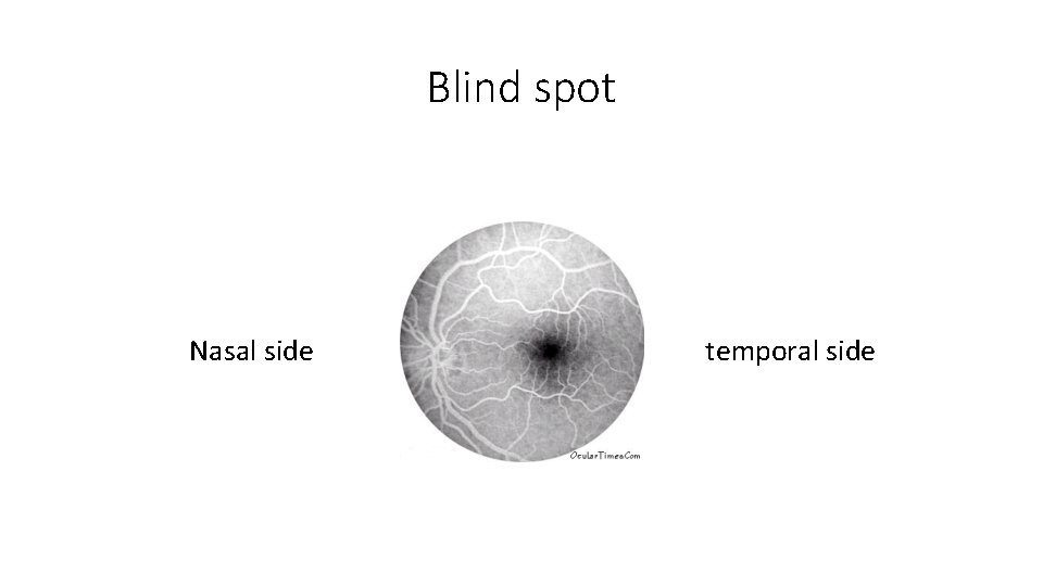 Blind spot Nasal side temporal side 