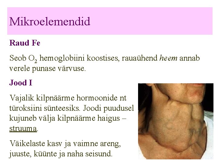 Mikroelemendid Raud Fe Seob O 2 hemoglobiini koostises, rauaühend heem annab verele punase värvuse.