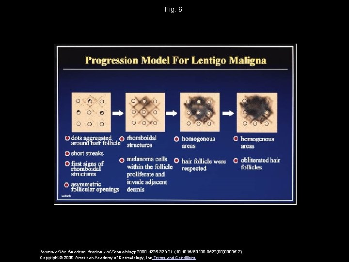 Fig. 6 Journal of the American Academy of Dermatology 2000 4225 -32 DOI: (10.