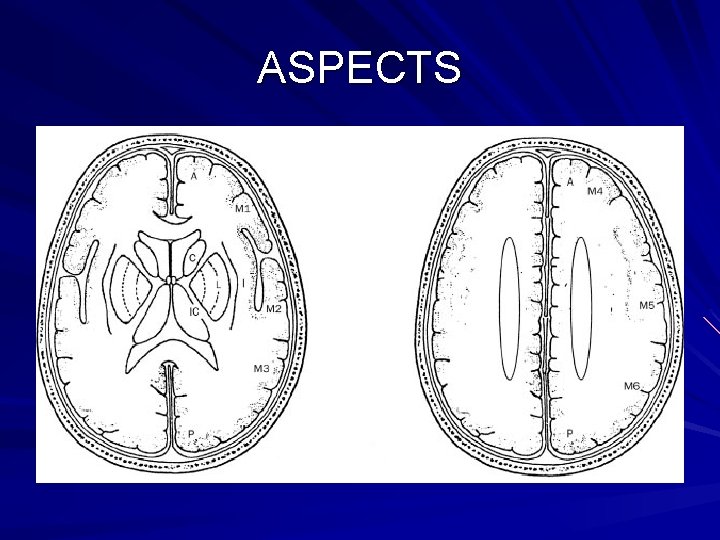 ASPECTS ASPECTS