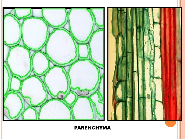 PARENCHYMA 