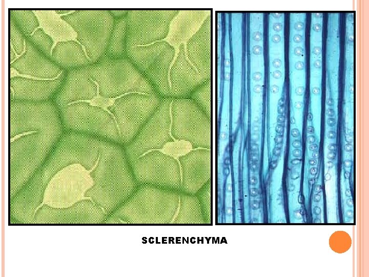 SCLERENCHYMA 