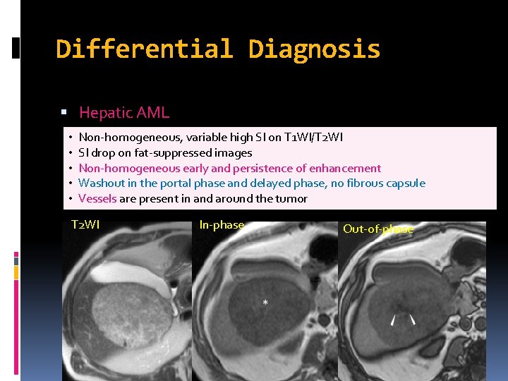 Differential Diagnosis Hepatic AML • • • Non-homogeneous, variable high SI on T 1 Differential Diagnosis Hepatic AML • • • Non-homogeneous, variable high SI on T 1