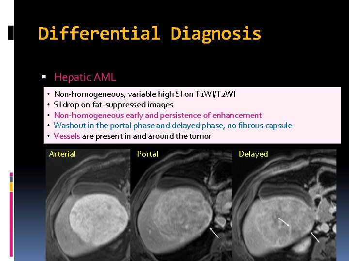 Differential Diagnosis Hepatic AML • • • Non-homogeneous, variable high SI on T 1 Differential Diagnosis Hepatic AML • • • Non-homogeneous, variable high SI on T 1