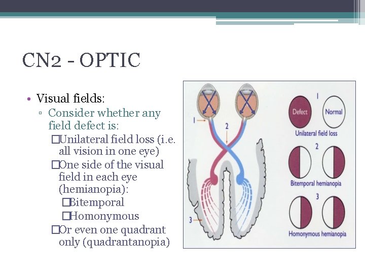 CN 2 - OPTIC • Visual fields: ▫ Consider whether any field defect is: