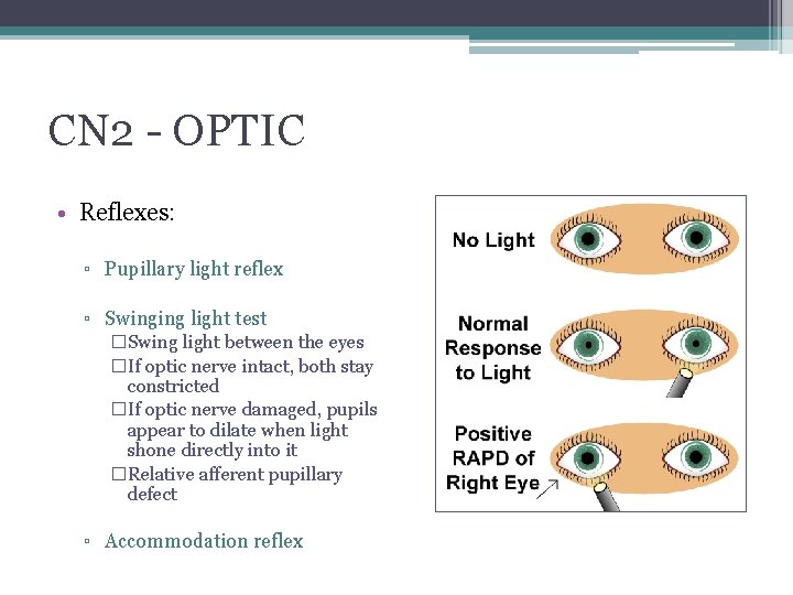 CN 2 - OPTIC • Reflexes: ▫ Pupillary light reflex ▫ Swinging light test