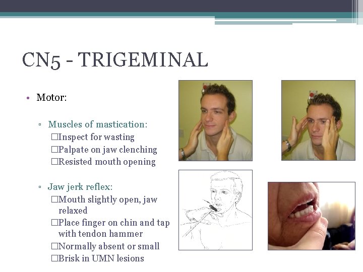 CN 5 - TRIGEMINAL • Motor: ▫ Muscles of mastication: �Inspect for wasting �Palpate