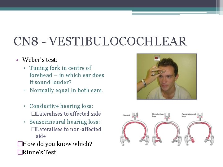 CN 8 - VESTIBULOCOCHLEAR • Weber’s test: ▫ Tuning fork in centre of forehead