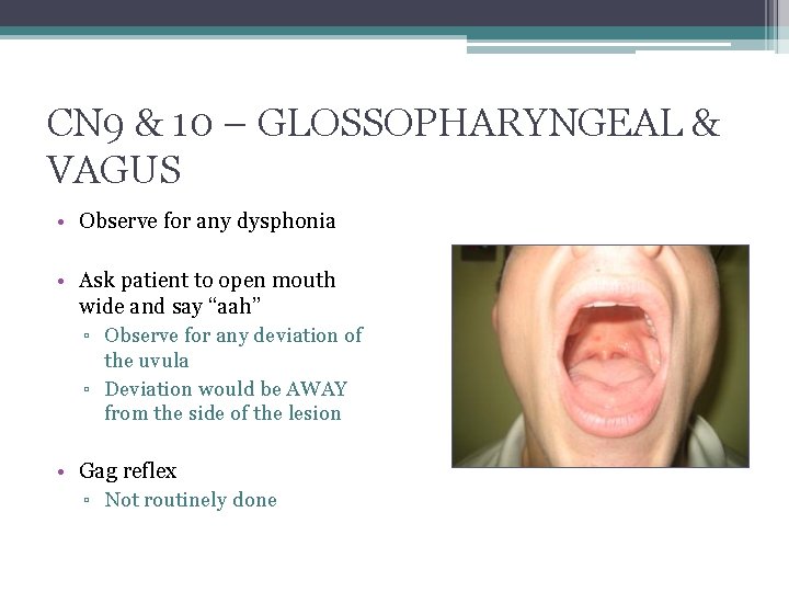 CN 9 & 10 – GLOSSOPHARYNGEAL & VAGUS • Observe for any dysphonia •