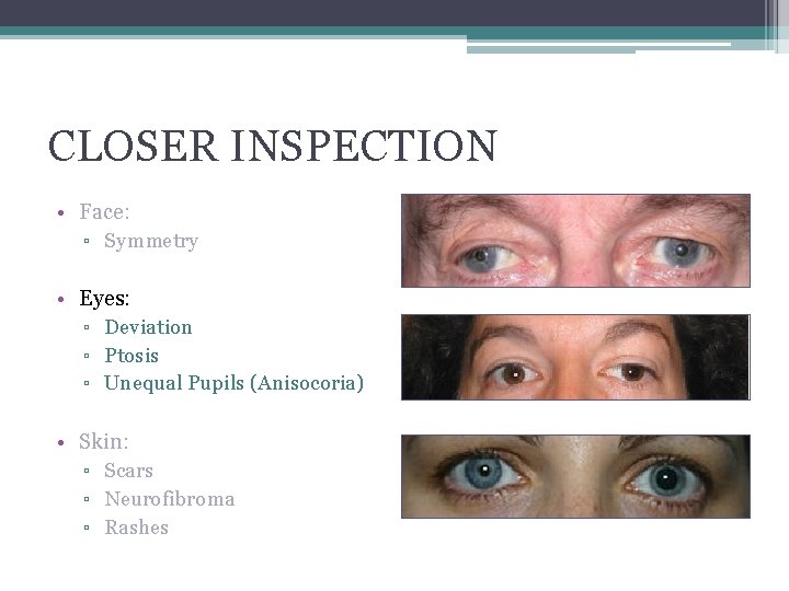 CLOSER INSPECTION • Face: ▫ Symmetry • Eyes: ▫ Deviation ▫ Ptosis ▫ Unequal