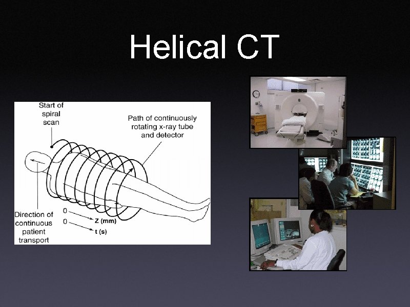 Helical CT 