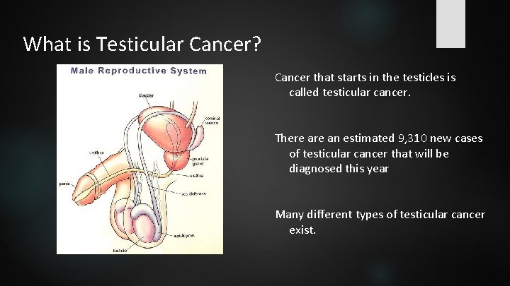 What is Testicular Cancer? Cancer that starts in the testicles is called testicular cancer.