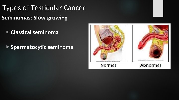 what is invasive adenocarcinoma of lung