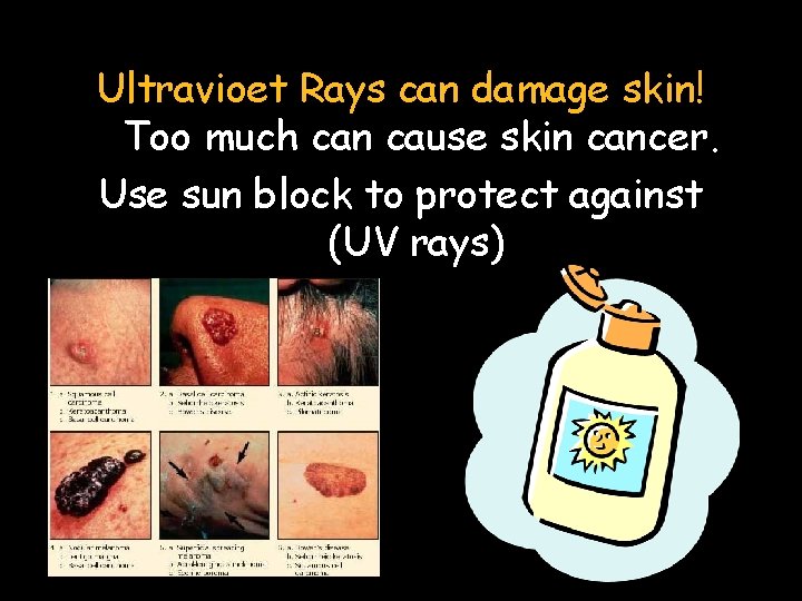 Ultravioet Rays can damage skin! Too much can cause skin cancer. Use sun block